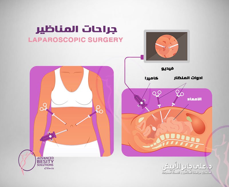 جراحات المناظير