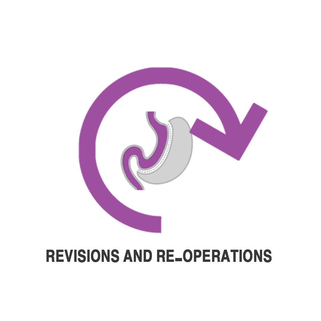 عمليات الاعادة و التصحيح