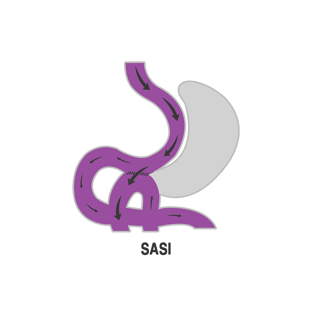 عملية الساسي